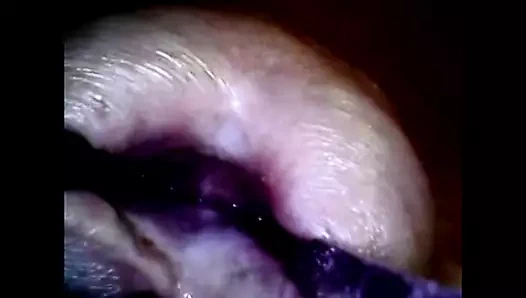 ejac-inner aventure ile tam iç horoz üretra endoskop