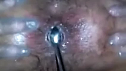 Götümü genişletiyorum