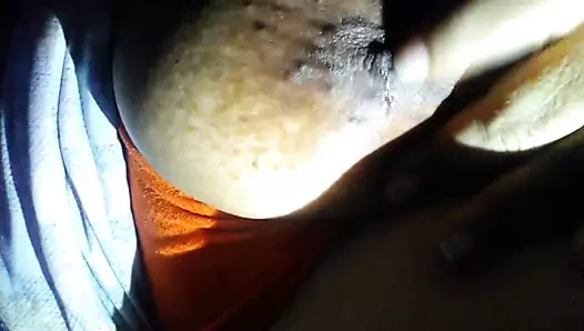 Büyük siyah areolalar