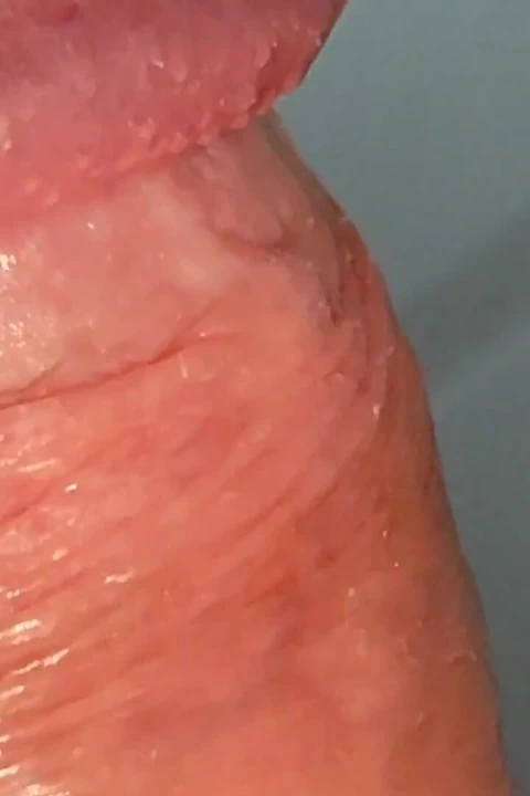 Bir Penis Başı Deliği Nasıl aşırı Derecede Genişletilir.