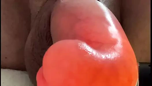 Glukoz Salin İnfüzyonu