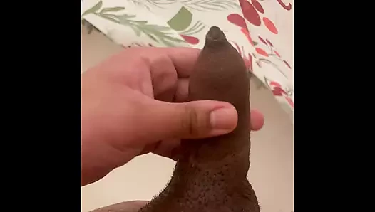 Fimosis mastürbasyon yapıyor