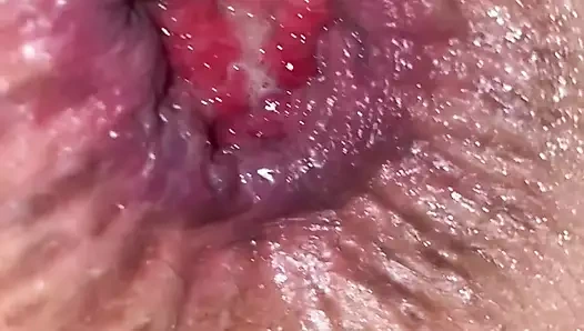 Açık delikli en iyi yakın çekim anal boşalma !!!!!!