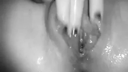 Squippet (fışkırtma snippet'i)