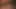 Beverly hills teaser 3