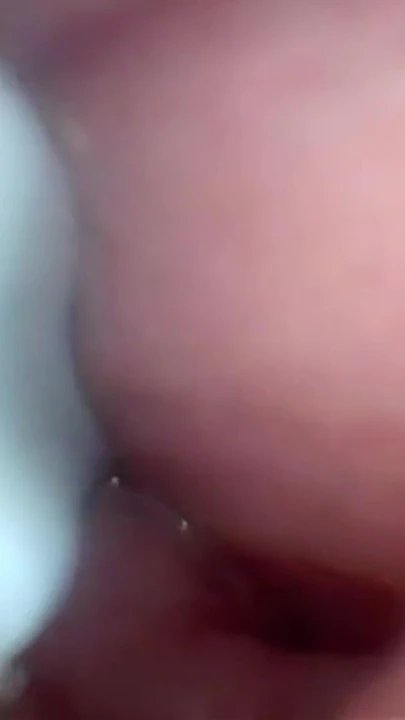 Serviks geniş esneyen amcık endoskopunda sperm! | Klip 2