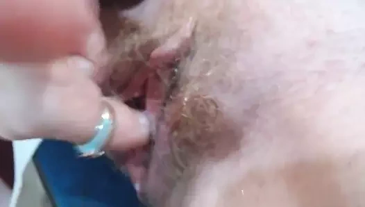 Masturbazione Paziente