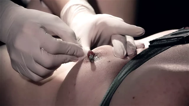 Ep. 24 Needle torture