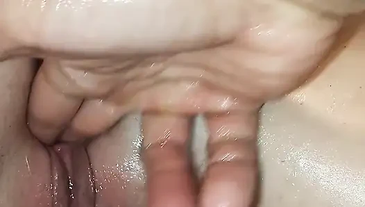 Fışkırtma parmak