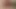 gf anal