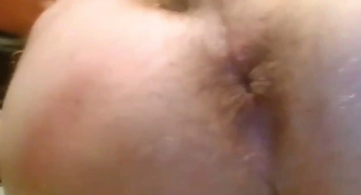 Anal mastürbasyon