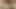 ameliyat sonrası travesti