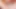 Extreme anal transvestite (psykoanal)