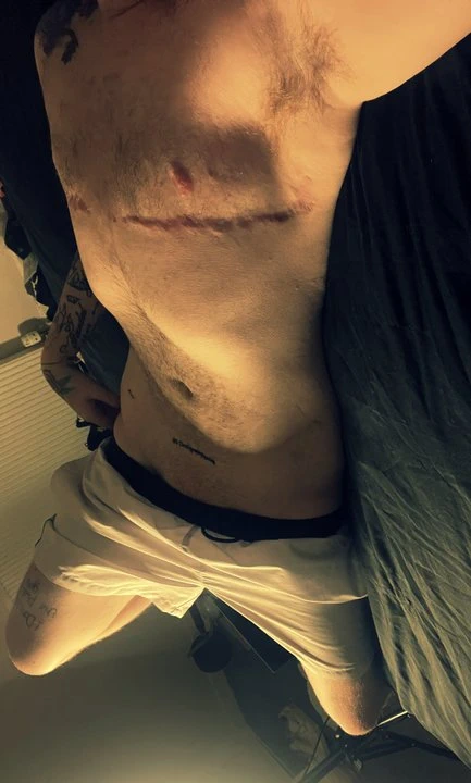 İskoç trans erkek snapchat klipleri