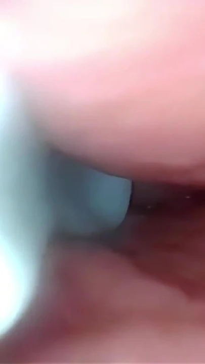 Serviks geniş esneyen amcık endoskopunda sperm! | Klip 1