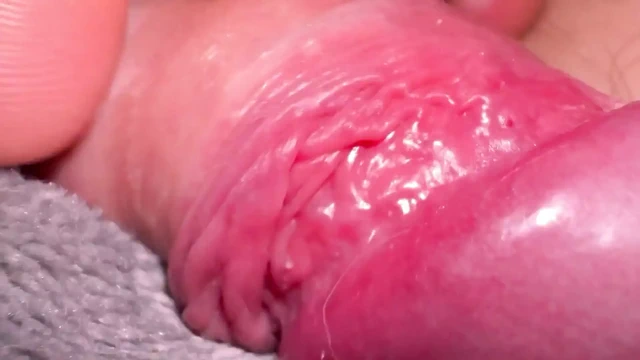 Sikimin üzerinde makro teni