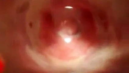 vajina içinde fincan