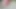 Derin üretral sondaj, 30cm derinliğinde sondaj çubuğu, cumshot, yakın çekim, silikon dilatör yerleştirme