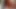 benim MİLF maruz crotchless bodystockings ve anal oyuncak
