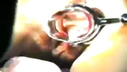 Zhangjiajing hemşireler Tayvanlı tayvan hemşireler(0054