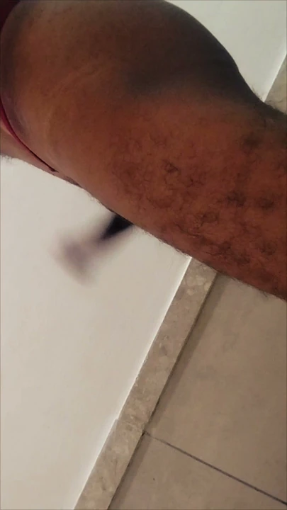 Sikle göt