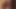 665
