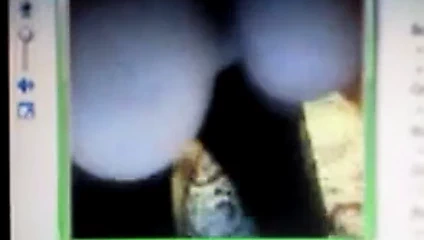 Büyük İrlandalı meme uçları