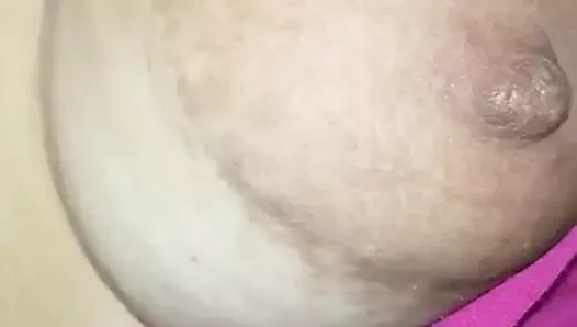 areolas grandes
