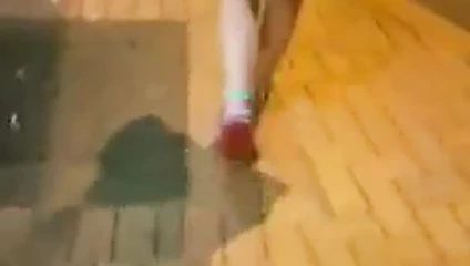 siyah nokta asyalı kadın