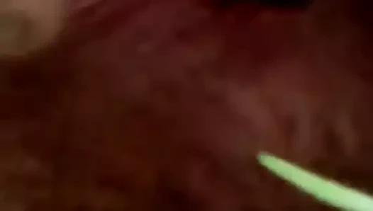 setnja i prstic u guzu