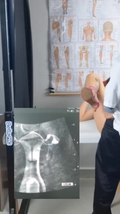 "düşkünü, karısı ve jinekolog ultrasonda yaramaz!" den unutulmaz bir an!