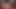 xxx