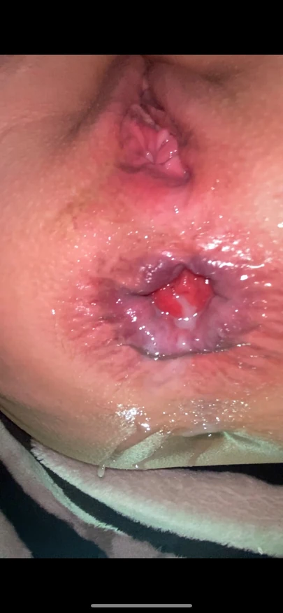 Сломанный красоткой анал милфы не может остановить сквирт от анального траха