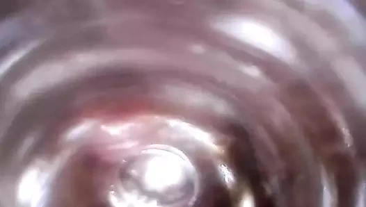 Üretral test tüpü