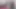 Comp 2 Speculum Edit! Anal ve amcık spekulum yakın çekimler!