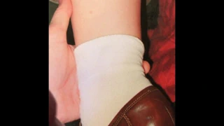 Cum haraç bacak bölünme