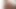 Das Steht Dir Gut Music Video