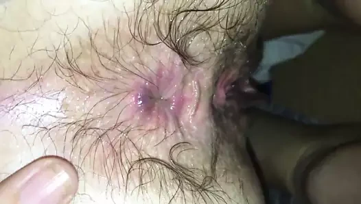 Wife hairiest asshole ever