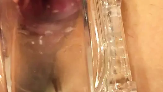 karısı spekulum içinde KEDİ serviks 1