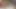 Ellili yaşlarında bol bir mazoşist, seks oyuncağını ona vidalıyor ve anal deliklere ulaşıyor, ardından oyuncak içinde sıkışmış anal sekste ölüyor