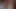 AUTSCH, DAS ERSTE MAL ANAL