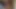 vid1amthroat