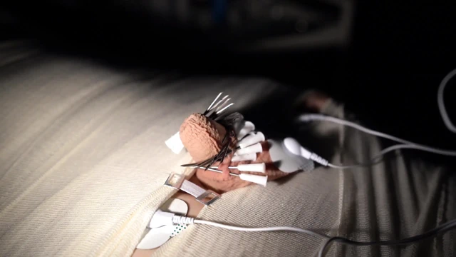 Tıbbi oyun eğlencesi, mumyalama, iğne cbt ve elektro