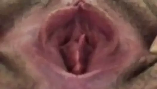 Yayılan her iki deliği kapatın