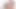 Youmixporn nataly altın üçlü anal terapide.
