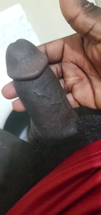 Siyah kıllı yarak