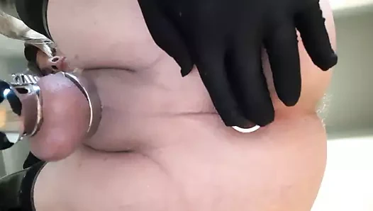 Götümde orta boy fiş