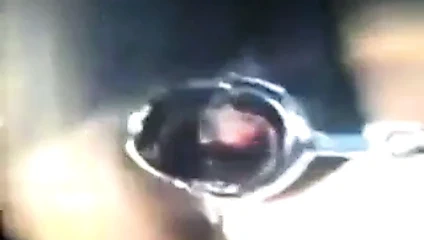 Zhangjiajing hemşireler Tayvanlı tayvan hemşireler(002