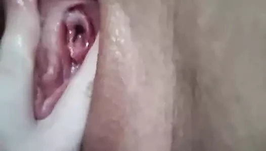 Transboy damlayan deliğe dokunuyor