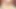 Stefie'nin sperm deliği için grup dolgusu